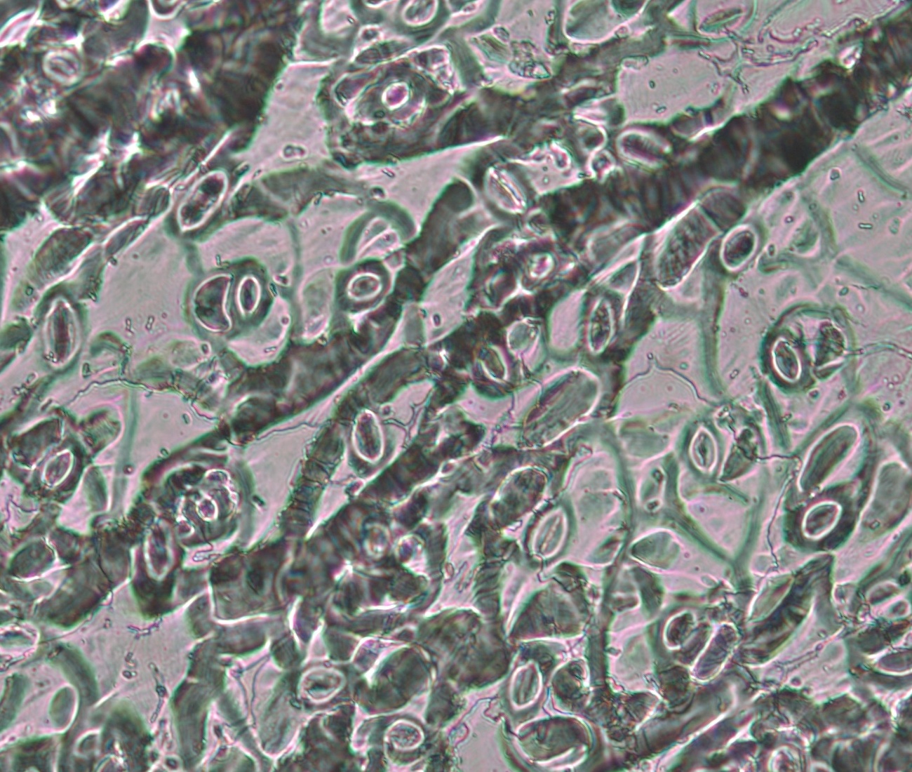 Raw input image containing stomata (click the right image to see pipeline output)